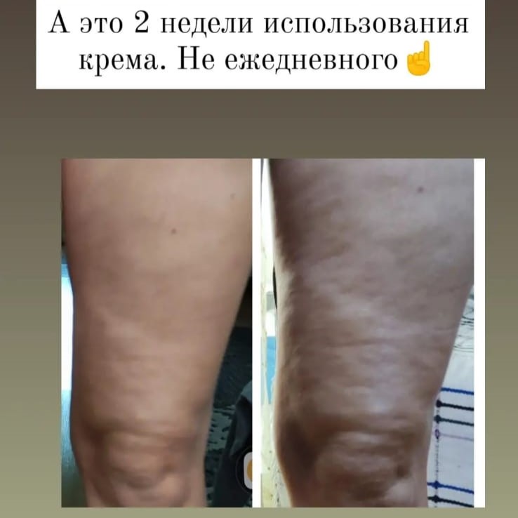 Лимфодренажный лосьон для тела